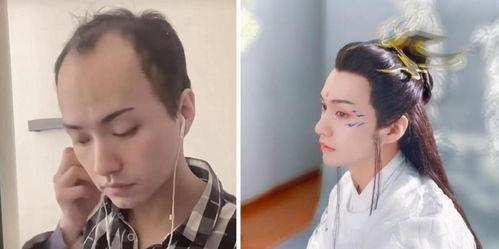 女网红状告秃顶男友